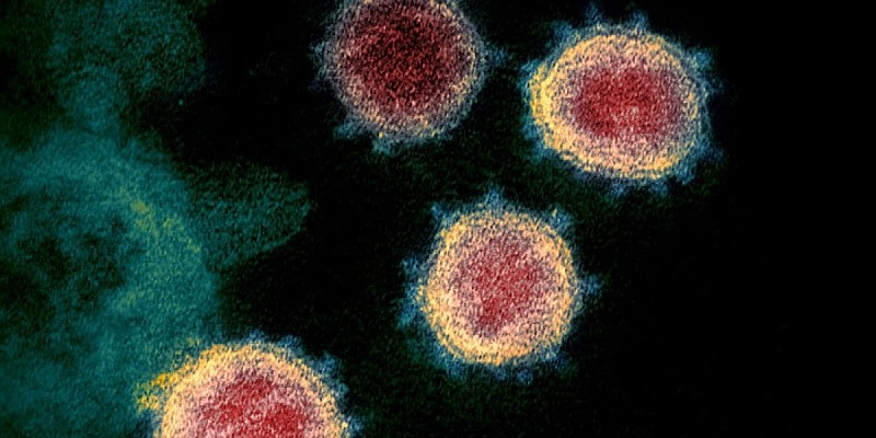 sarscov2 microscopio