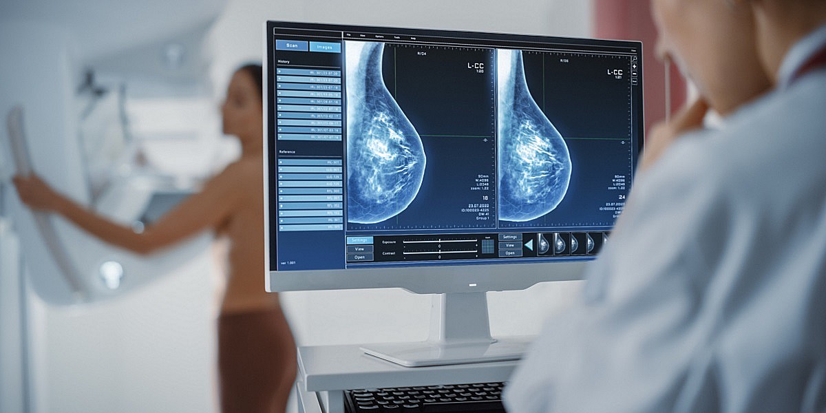 Tumore al seno, allo Ieo scoperta nuova forma ereditaria. Cruciale il