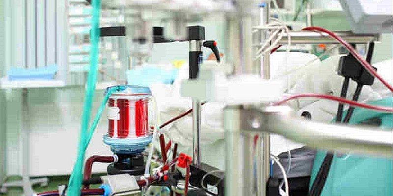 ecmo-terapia-intensiva
