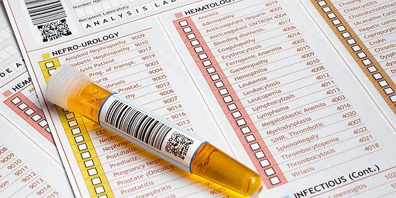 esame-urine-cellule-epiteliali