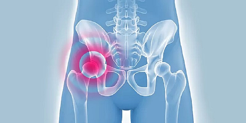 dolore-anca-coxalgia