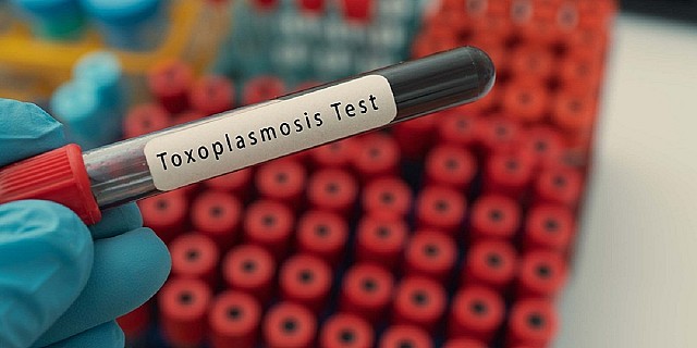 toxoplasmosi test
