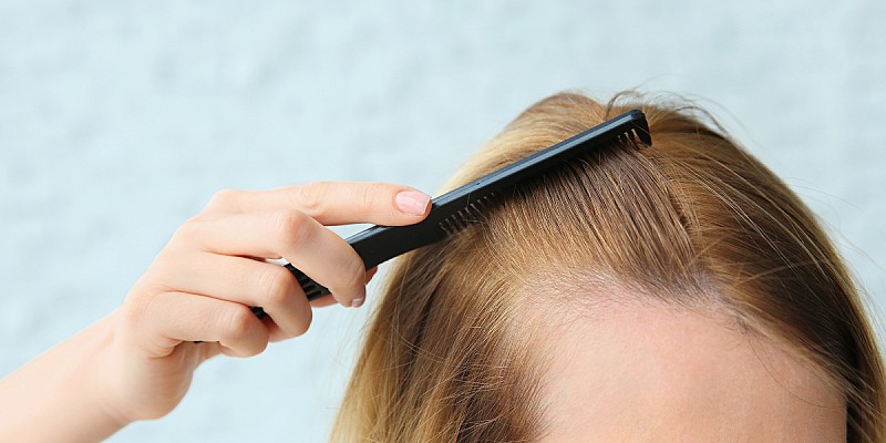 1510 cuoio capelluto