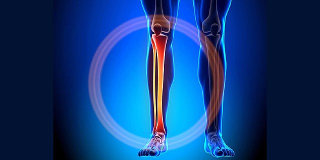 tibia-lesioni