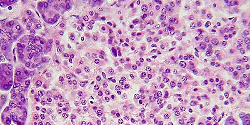 Langerhanssche_Insel