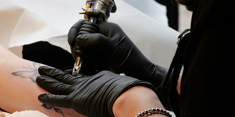 28.03 art 1 laser tattoo removal