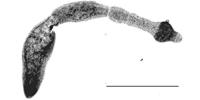 Echinococcus_multilocularis