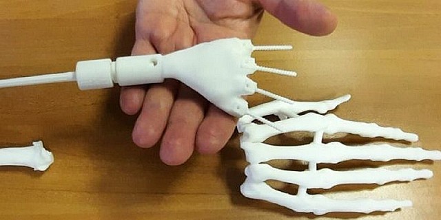 Prototipo-Protesi-Polso-in-3D-e1684507532476