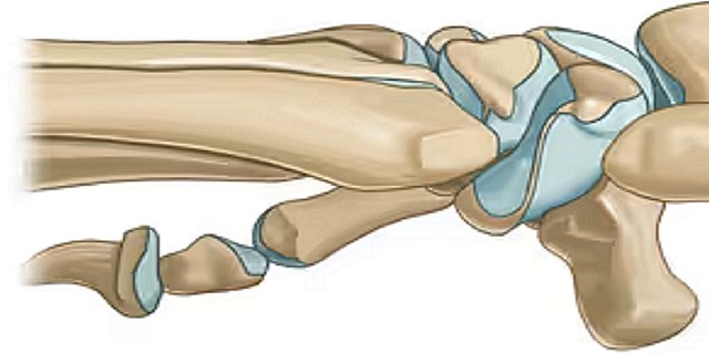 testa ulna