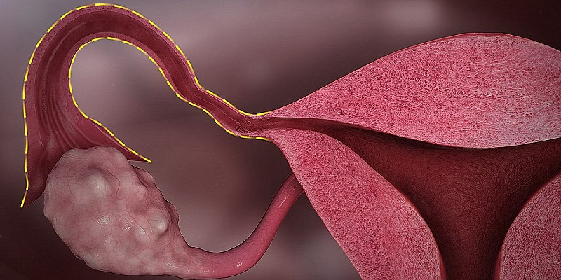 1280px-Fallopian_tube