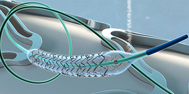 Immagine in evidenza