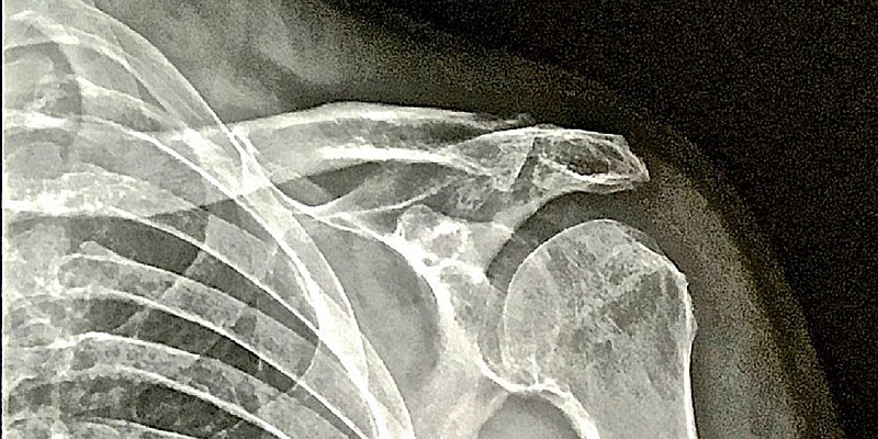 25662736167_378a1dae6f_b