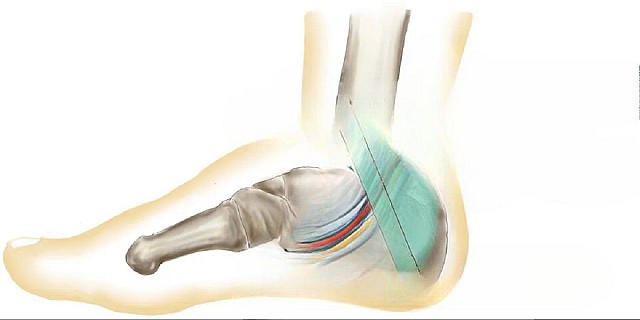 Structures_within_the_tarsal_tunnel_-_with_text